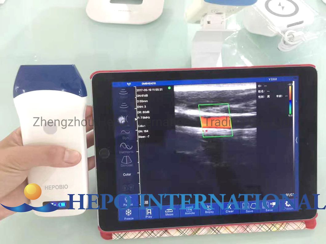 Hospital Portable Medical Ultrasound Scanner 3D 4D Color Doppler Machine