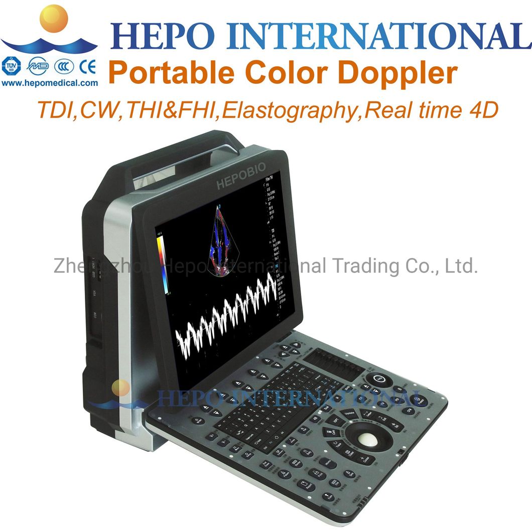 Hospital Portable Medical Ultrasound Scanner 3D 4D Color Doppler Machine