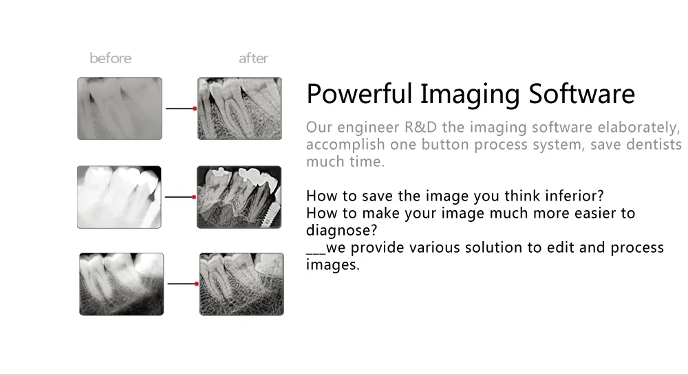 Hot Sale Hdr USB Dental X Ray Sensor System