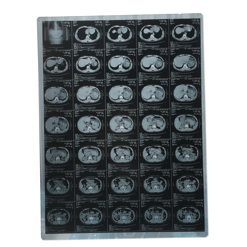 Hot Selling Laser Imager Blue Medical Films Printer for Medical Image