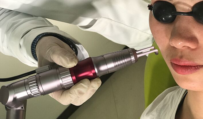 Hot Selling Professional Q Switch ND YAG Laser Tattoo Removal Equipment Eo Q-Switch 1064/532 Nm ND YAG Laser Tattoo Removal Machine