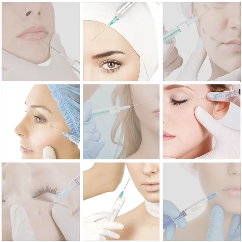 Hyaluronic Acid for Removing Deep Facial Wrinkle 2.0ml Dermal Filler