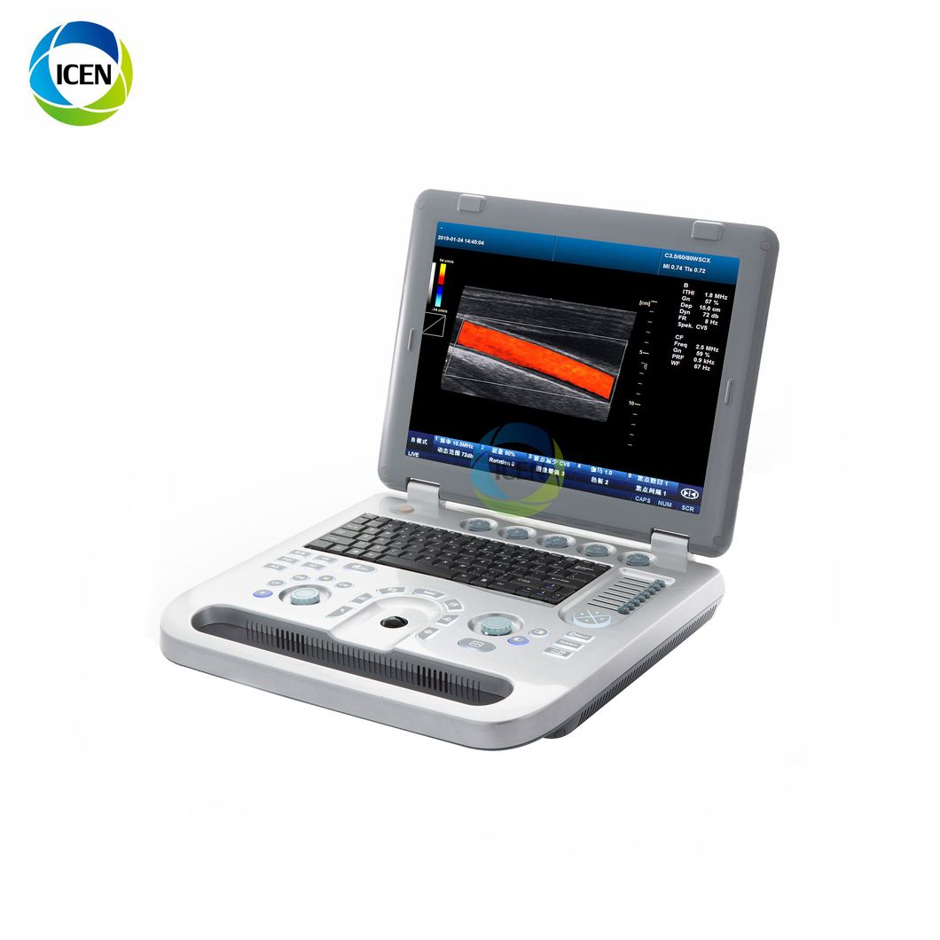 in-Ab50c Cheap Medical 4D Colour Doppler Ultrasound Scan Machine Scanner for Pregnancy