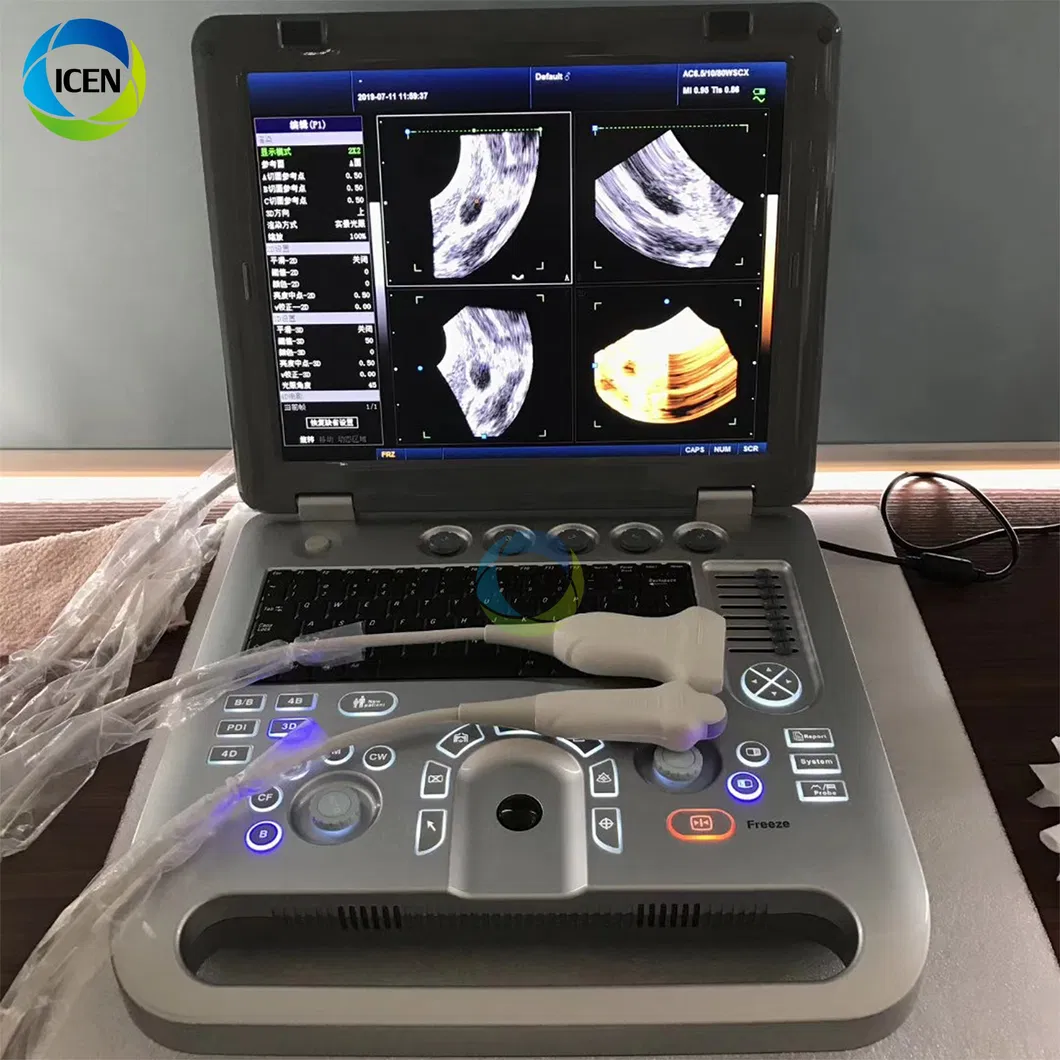 in-Ab50c Digital Portable Laptop Cw 4D Color Doppler Ultrasound Machine Scanner