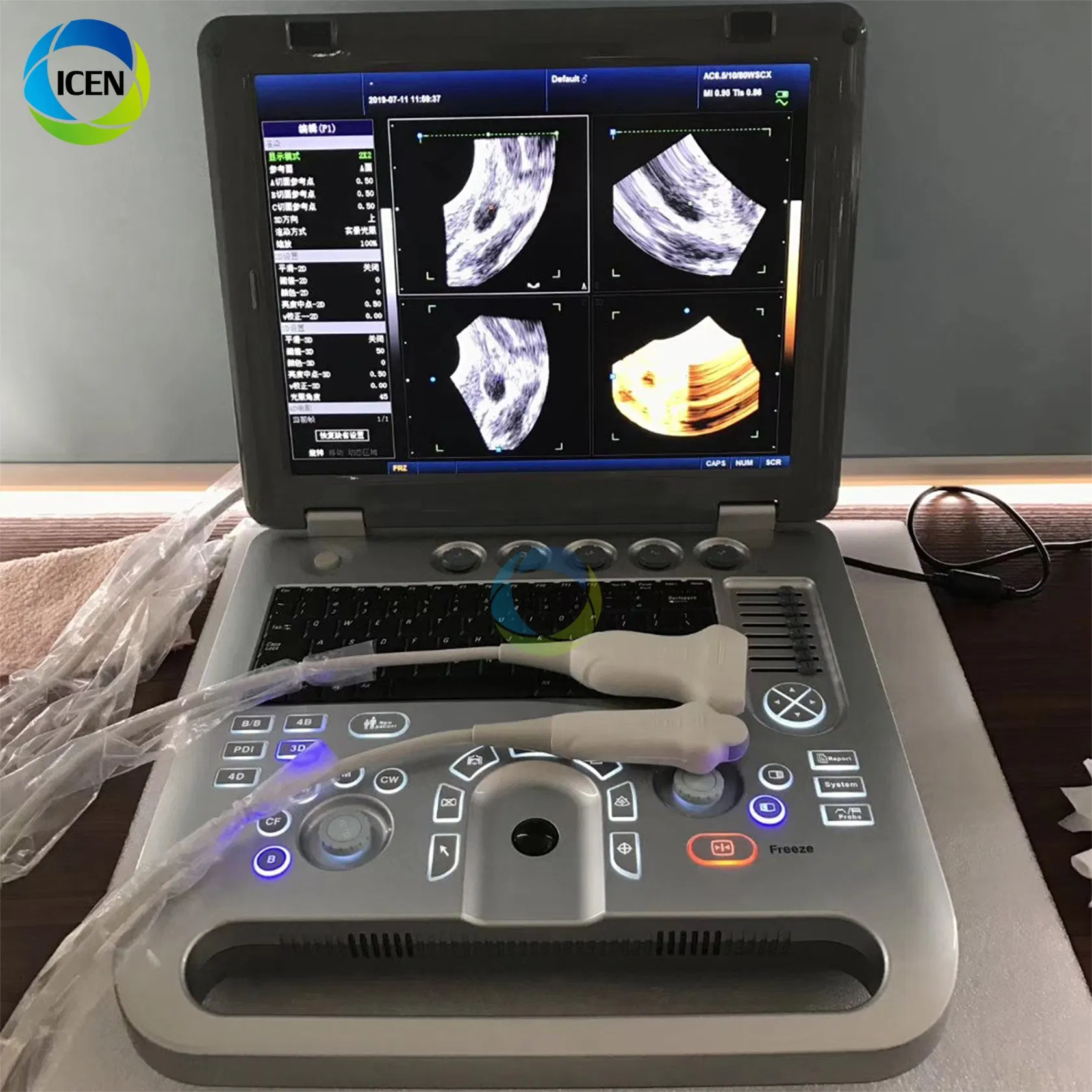 IN-AB50C Ultrasonic Equipment 4D Portable Ultrasound Color Doppler Machine Best Price