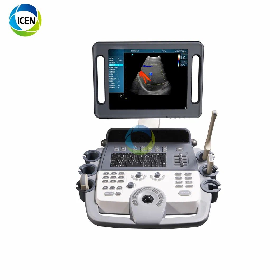 in-Ak12 16g 15 Inch Automatical/Manual Color Doppler Ultrasound Machine