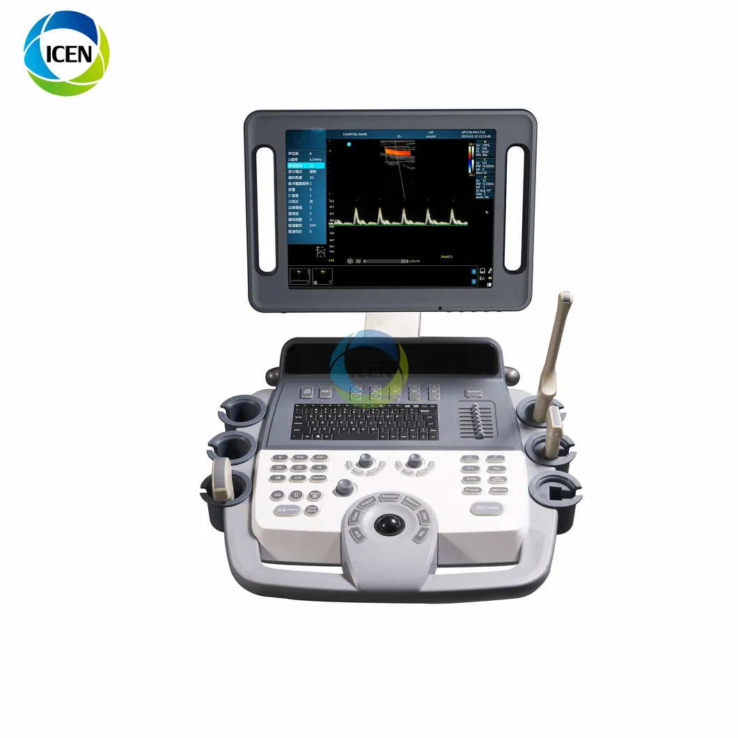 in-Ak12 16g 15 Inch Automatical/Manual Color Doppler Ultrasound Machine