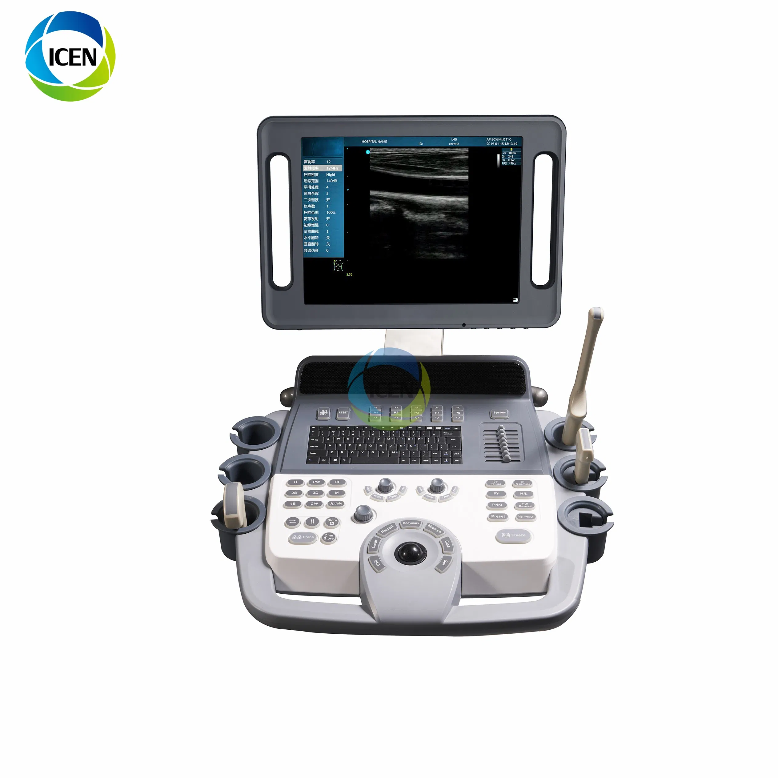 in-Ak12 16g 15 Inch Automatical/Manual Color Doppler Ultrasound Machine