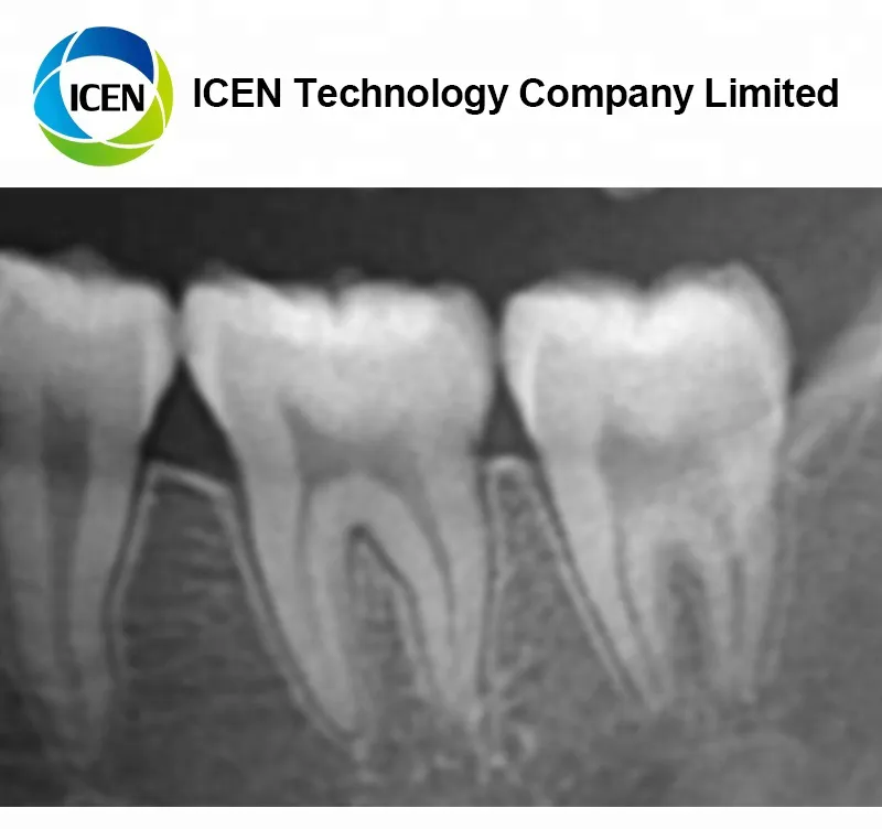 IN-D040 China Cheap Portable Digital Panoramic Dental X Ray Machine