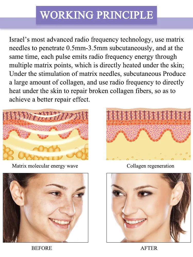 Latest Microneedle RF Fractional Estetico Maquina De Estetica SPA Beauty Equipment