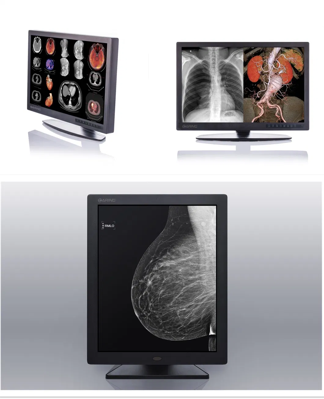 LED Display for Mammography Imaging