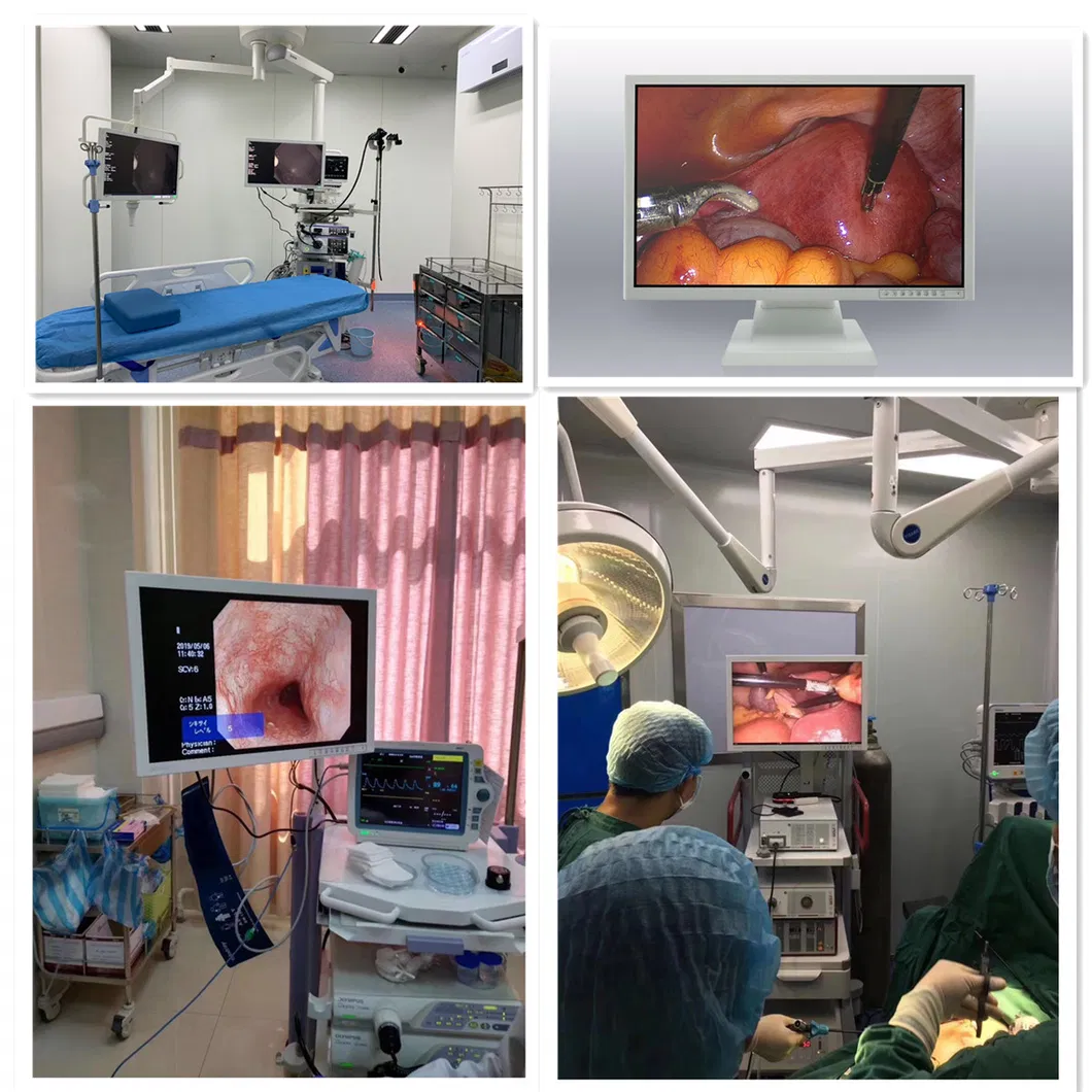 LED Display for Mammography Imaging