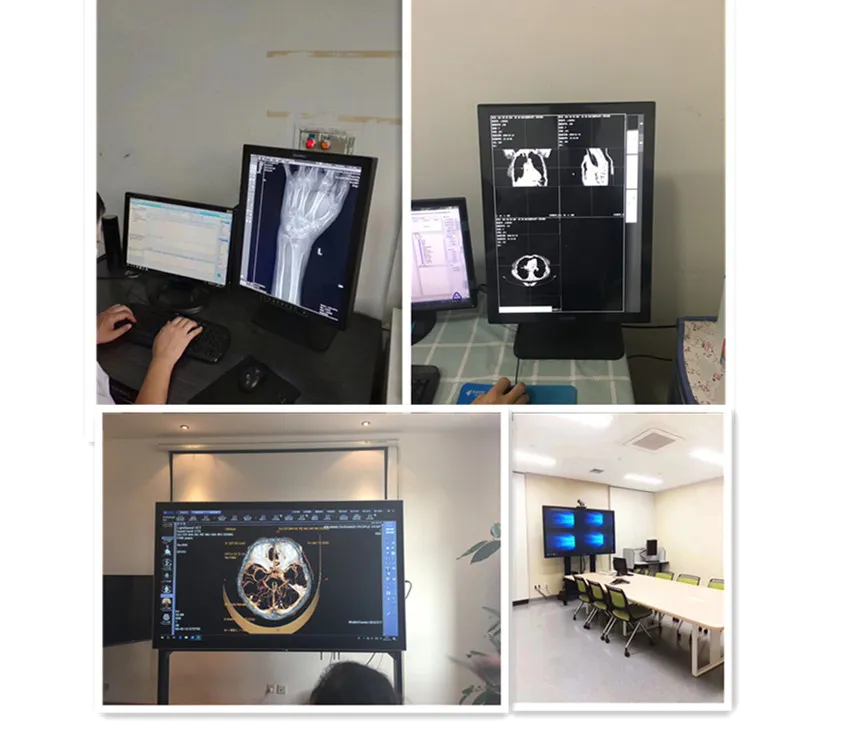 LED Display for Mammography Imaging