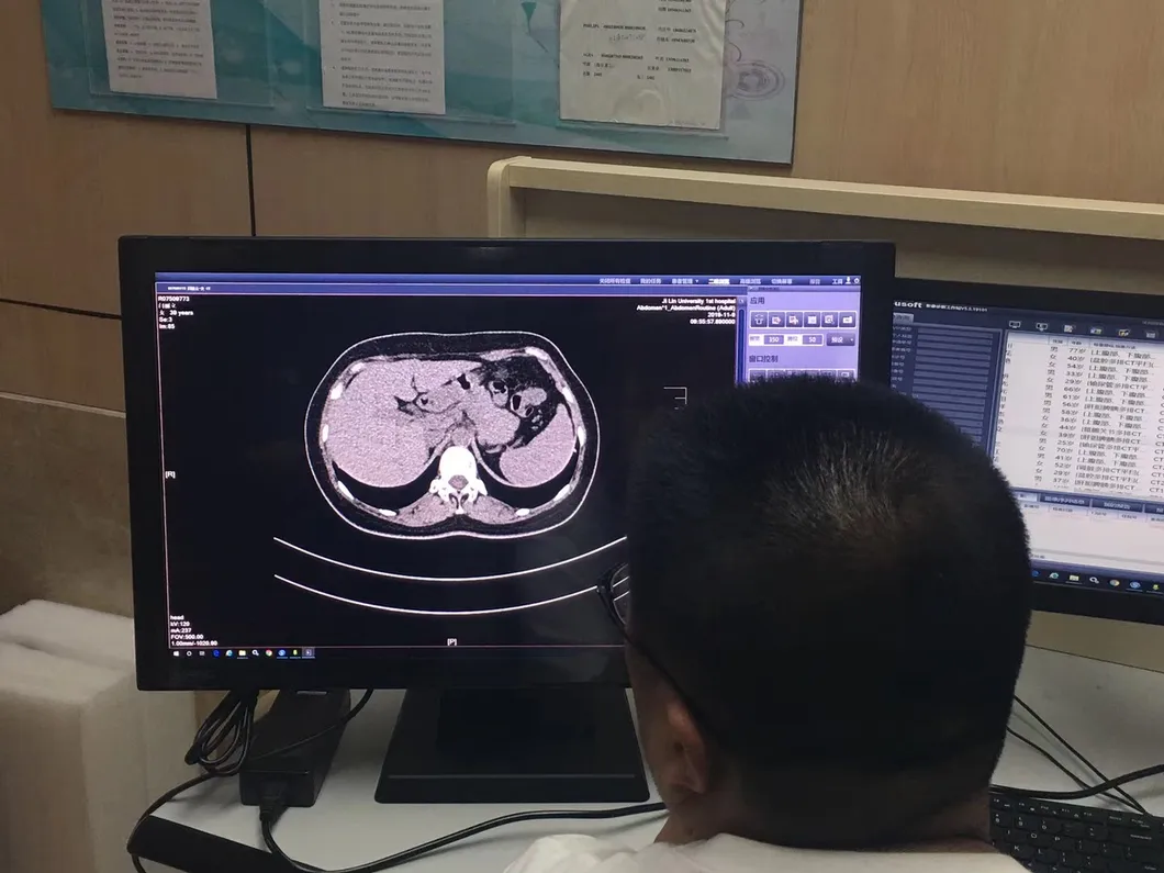 LED Display for Mammography Imaging