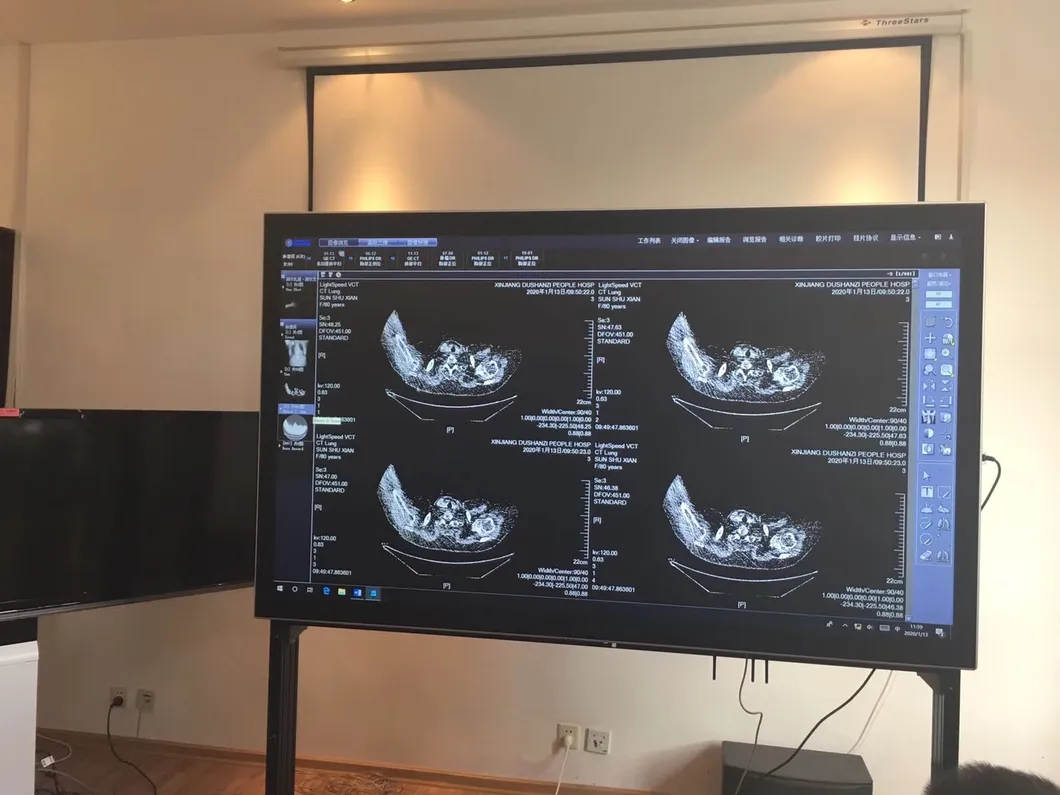 LED Display for Mammography Imaging