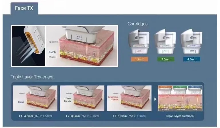 Liposonix Hifu 7D Lipohifu Slimming Machine for Body Weight Loss Smas Face Lifting