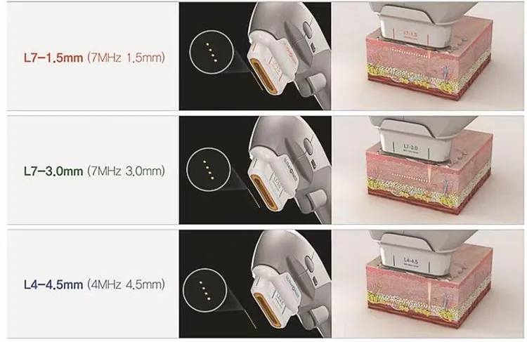 Liposonix Hifu 7D Lipohifu Slimming Machine for Body Weight Loss Smas Face Lifting