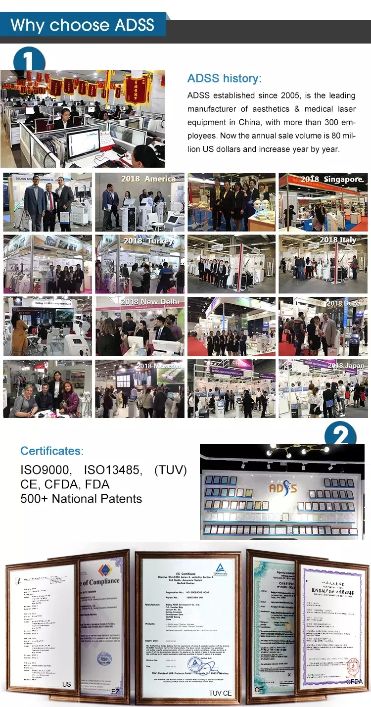 Long Pulse Laser Hair Removal 1064 ND YAG 755 Alexandrite Alex YAG