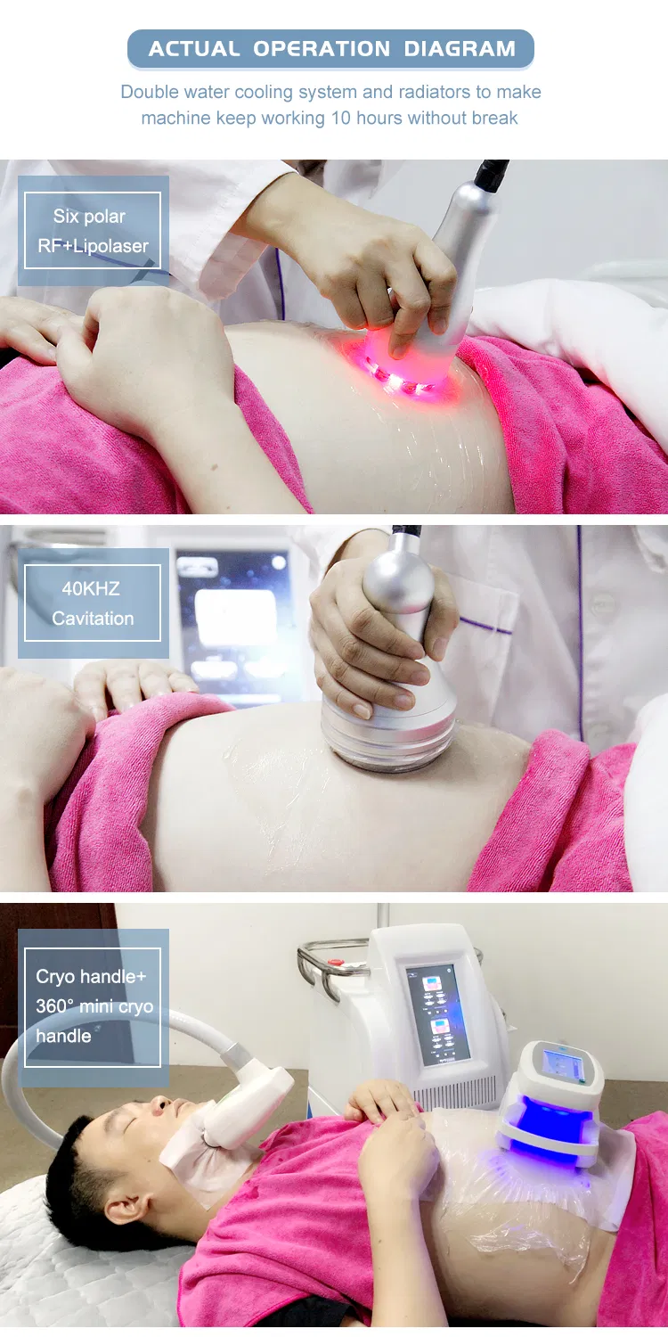 Medical CE Approved Cool Cryo Slimming Machine with 4 Cryo Handles Plus Cavitation and RF