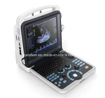 Medical Portable 3D/4D Olor Doppler Ultrasound Machine