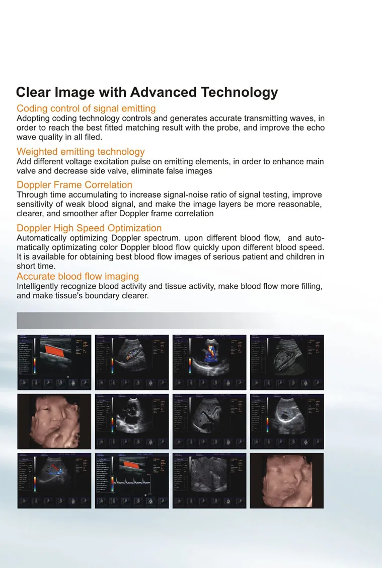 Mobile Cart 4D Doppler Fetal Image Ultrasound System