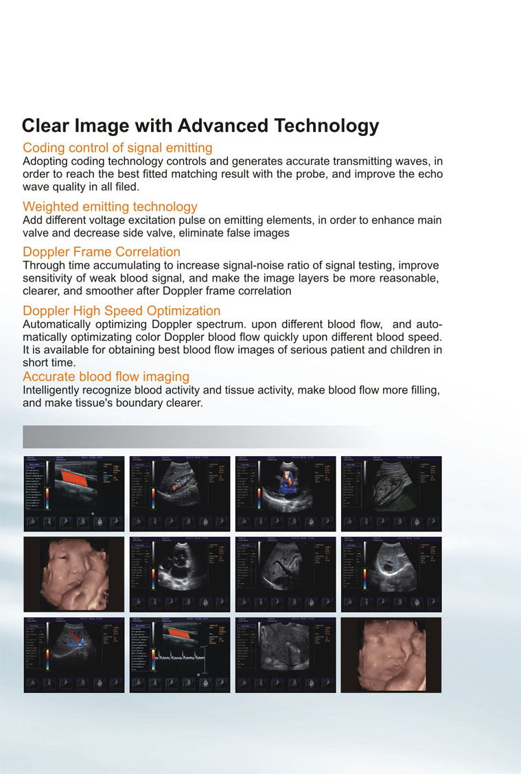 Mobile Cart 4D Doppler Fetal Image Ultrasound System