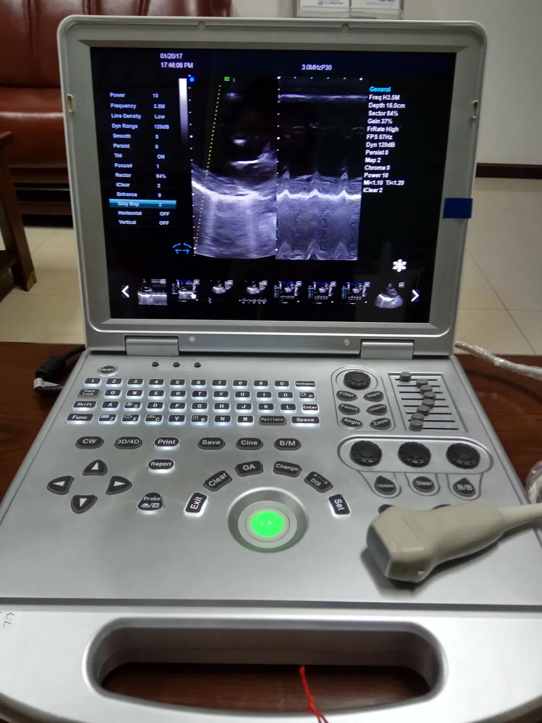 Multi-Language 12.1 Inch Color Hospital Emergency Patient Vital Signs Monitor