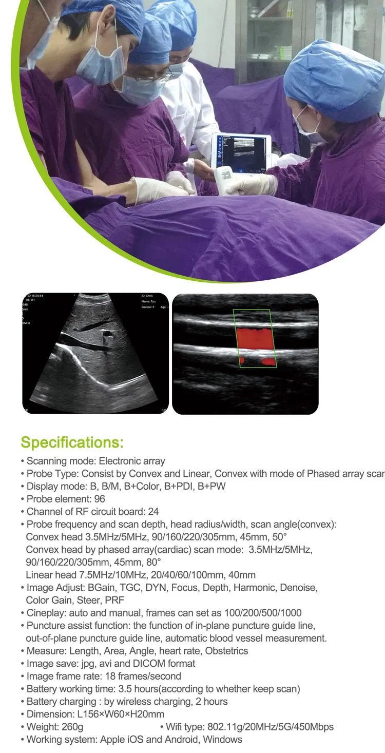 My-A023h Medical Products Handheld Portable Ultrasound Wireless Probe