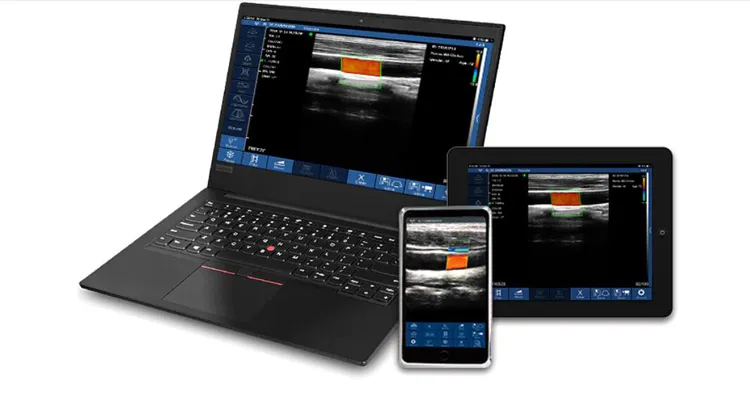 My-A023h Medical Products Handheld Portable Ultrasound Wireless Probe