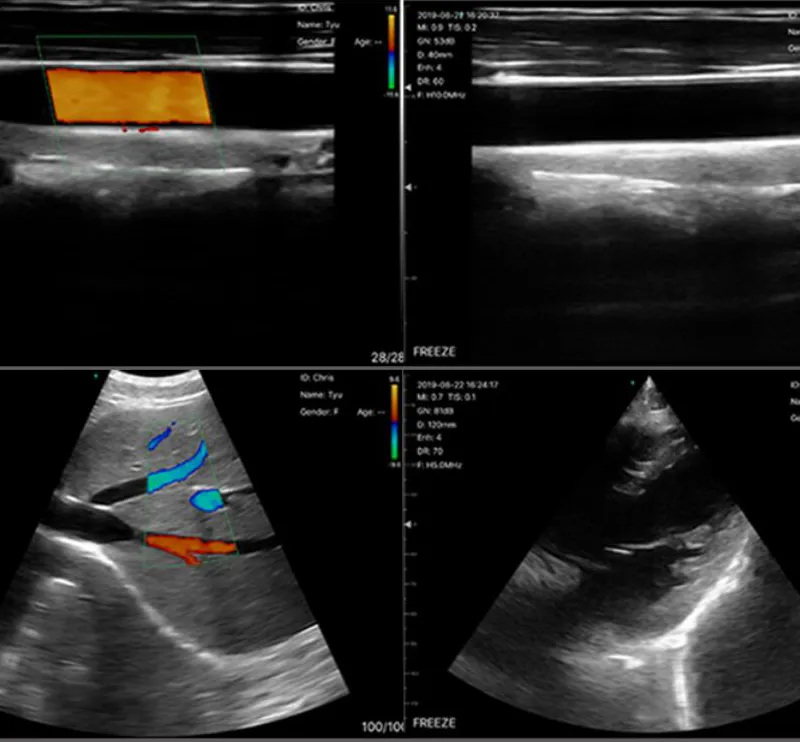 My-A023h Medical Products Handheld Portable Ultrasound Wireless Probe
