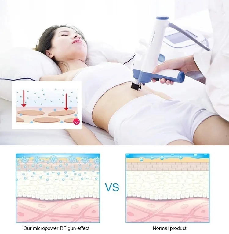 New Design Skin Rejuveration Vanadium-Titanium Meso Injector Mesotherapy Gun
