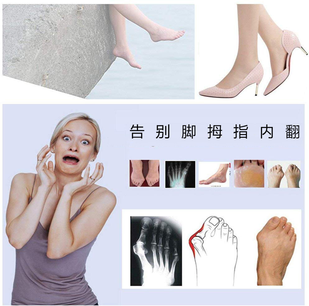 Night Hallux Valgus Correction Device Big Toe Separator Big Toe Separator Hallux Valgus Correction Nursing Set Wholesale