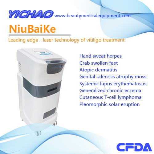 Niubaike Best Vitiligo Patches Treatment in World Vitiligo in Men