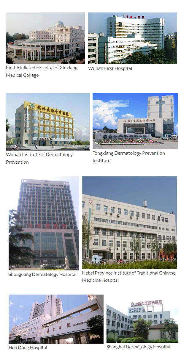 Niubaike Best Vitiligo Patches Treatment in World Vitiligo in Men