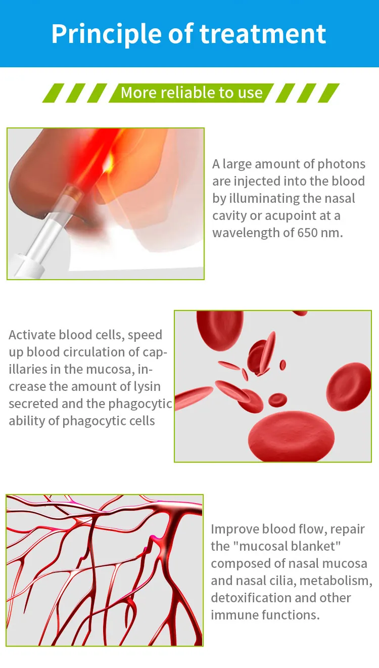 Nose Treatment Rhinitis Sinusitis 650nm Laser Therapy