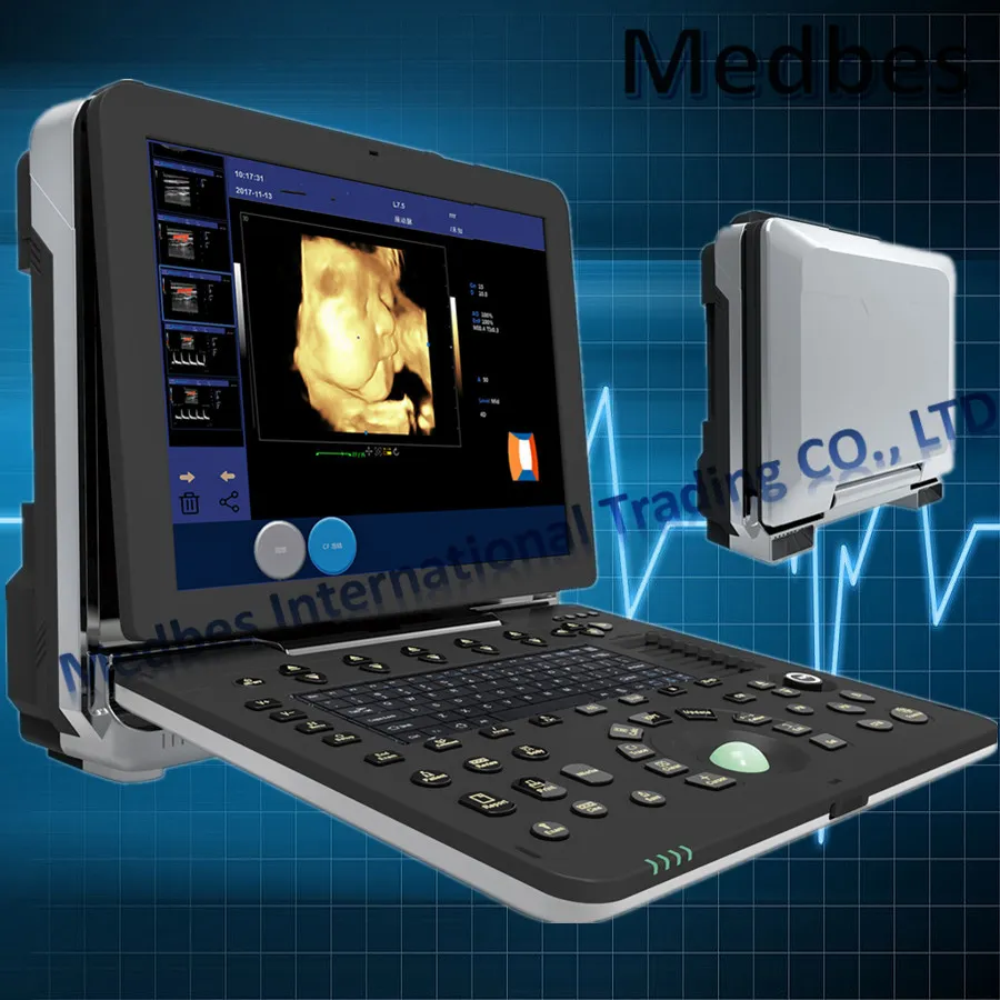 Obstetric and Gynecological 4D Fetal Doppler Ultrasound Scanner 4D Ecocardiograma
