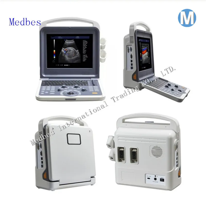 Obstetric and Gynecological 4D Fetal Doppler Ultrasound Scanner 4D Ecocardiograma