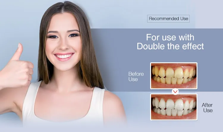 Onuge Dental Grade LED Teeth Whitening LED Smile Kit Machine