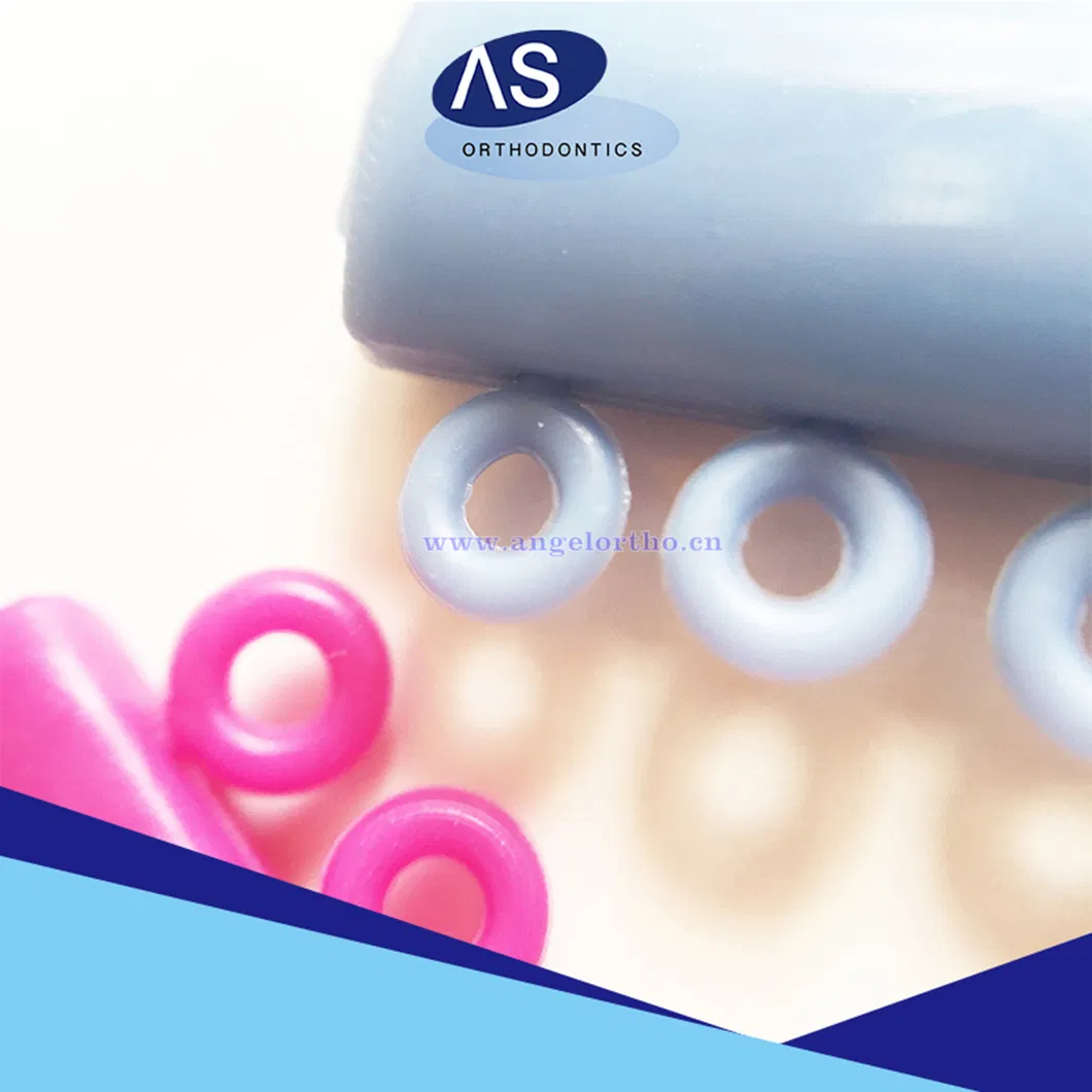 Orthodontic Ligature Ties