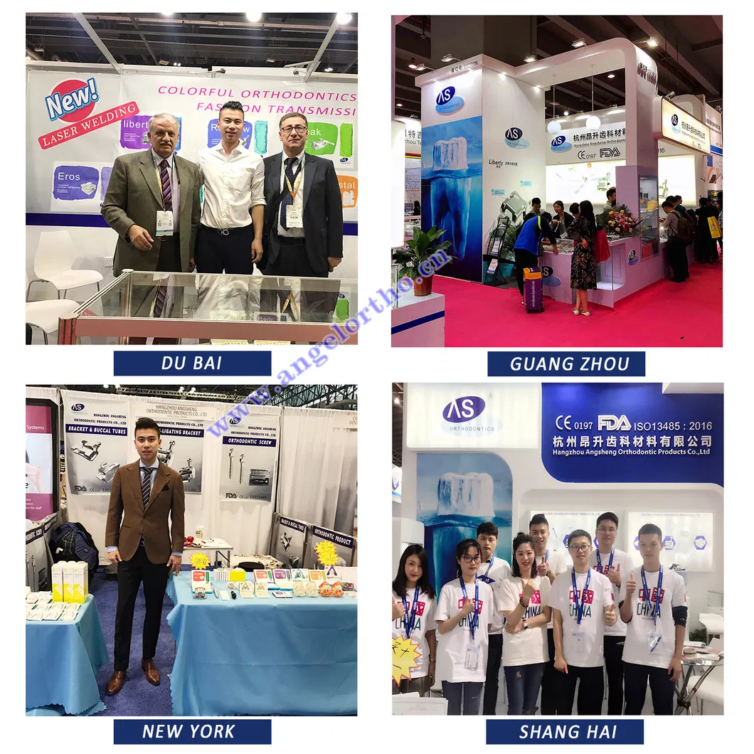 Orthodontic Ligature Ties