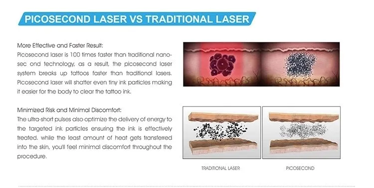 Pico Second Picosecond Laser Tattoo Removal Freckle Removal Machine for Sale