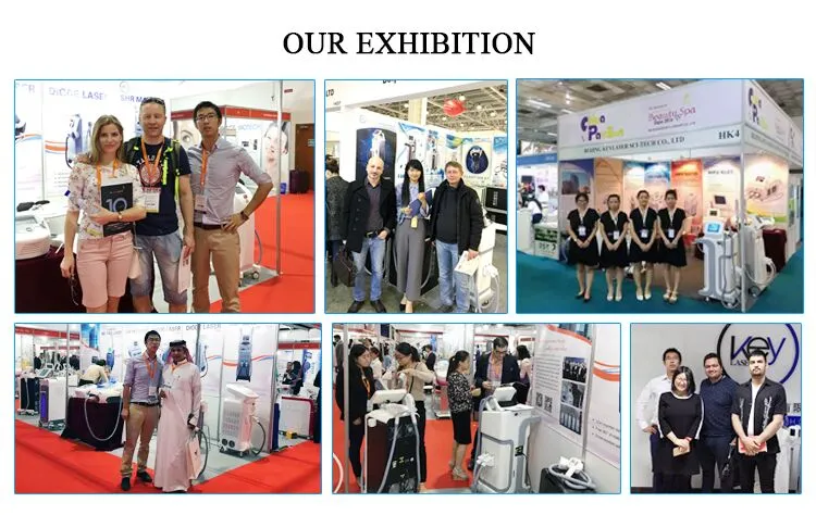 Picosecond Laser Remove Freckle, Age Pigment Remove Nevus of Ota/Congenital-Birthmark