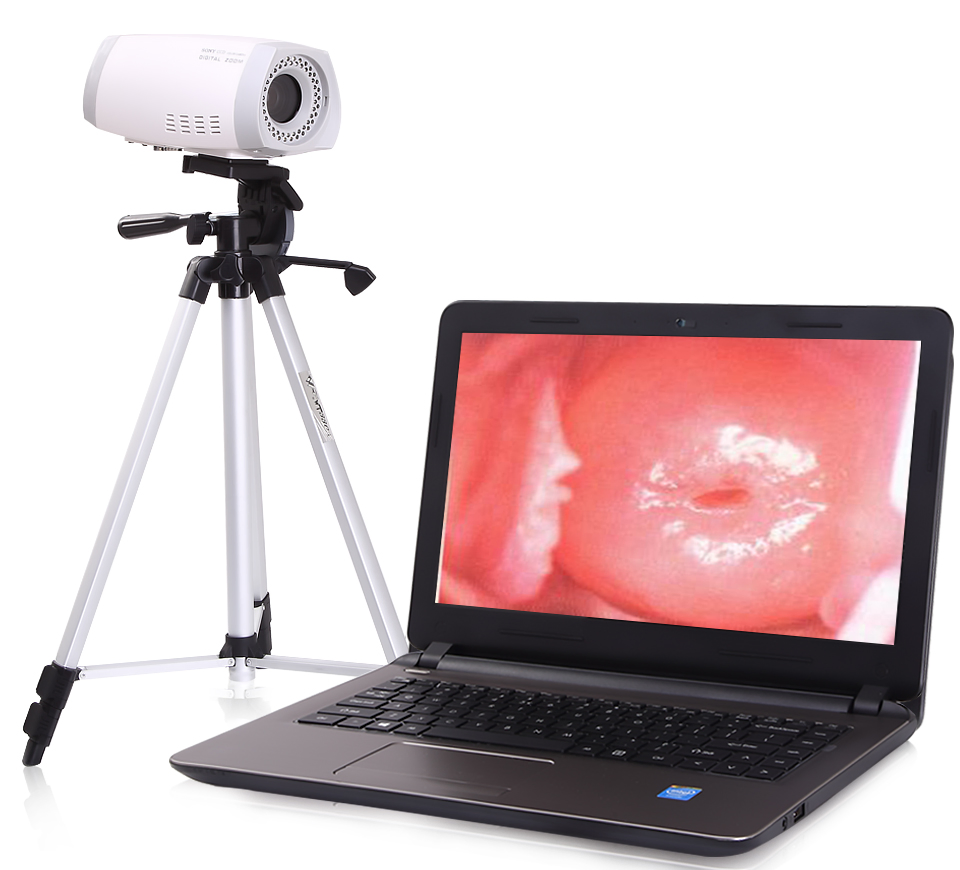 Pl-9800 Digital Portable Colposcope
