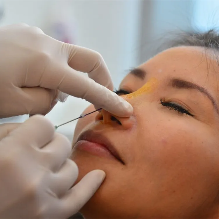 Plastic Surgery Pdo Cog Thread Cones Molding Cog 19g 100mm L Blunt