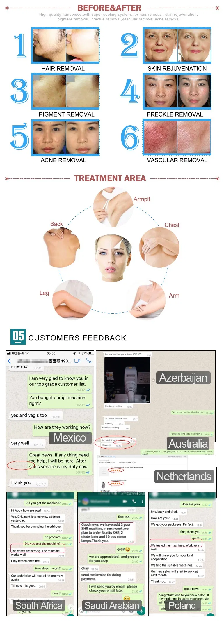 Popular Fast Hair Removal IPL Shr Laser Shr IPL Portable Shr Depilation Skin Care Beauty Machine Hair Removal Brown Hair Removal Machine Portable IPL