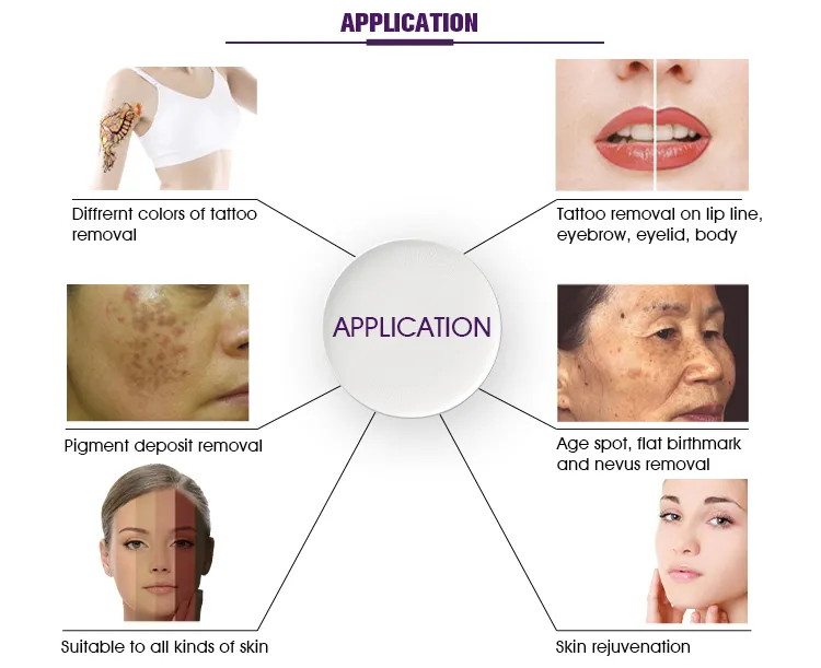 Portable Chloasma Q Switched ND YAG Laser Picosecond Laser Tattoo Removal Picosecond Laser Tattoo Removal Machine with CE