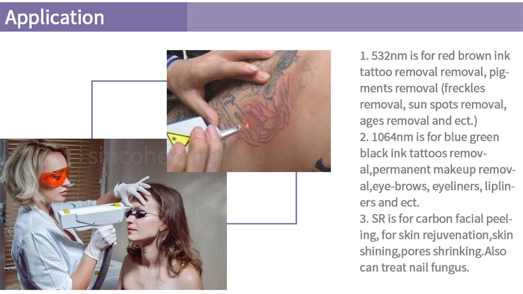 Portable Tattoo Removal Pigmentation Removal Q Switched ND YAG Laser 532nm 1064nm 1320nm Carbon Peeling Machine