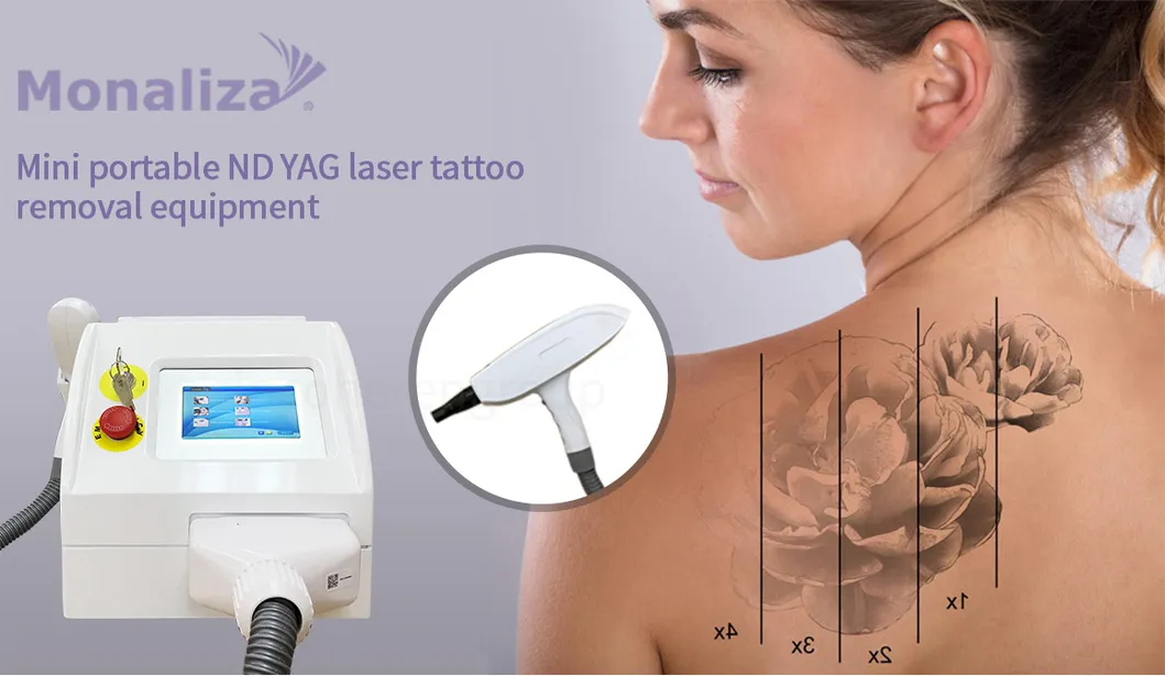 Portable Tattoo Removal Pigmentation Removal Q Switched ND YAG Laser 532nm 1064nm 1320nm Carbon Peeling Machine