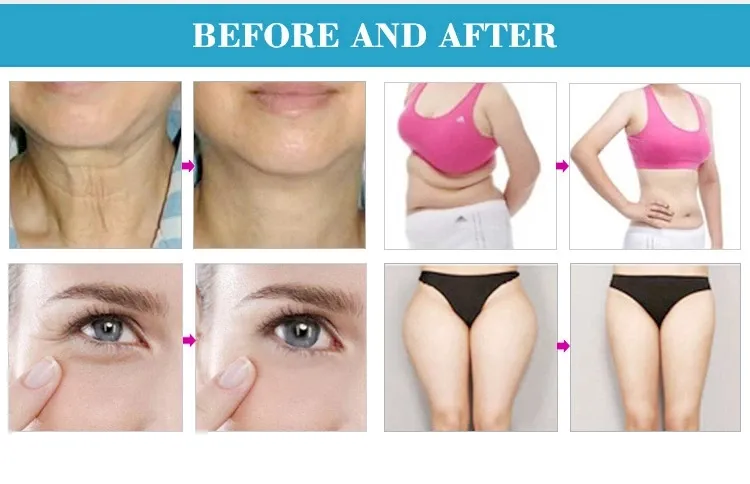 Portable V9 Vela 40K Cavitation Vacuum RF Cellulite Massage Slimming Machine