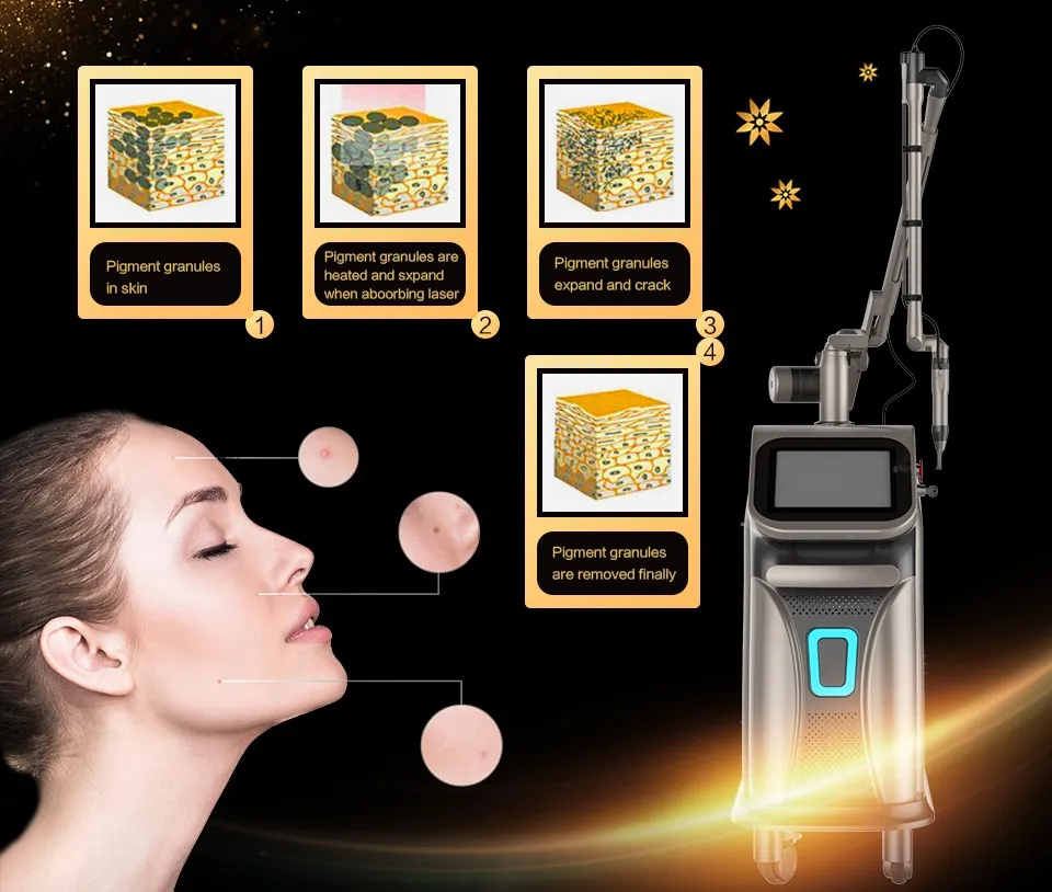 Professional ND YAG Q-Switch Picosecond Laser Body Skin Whitening Pico Tattoo Eliminate Freckles